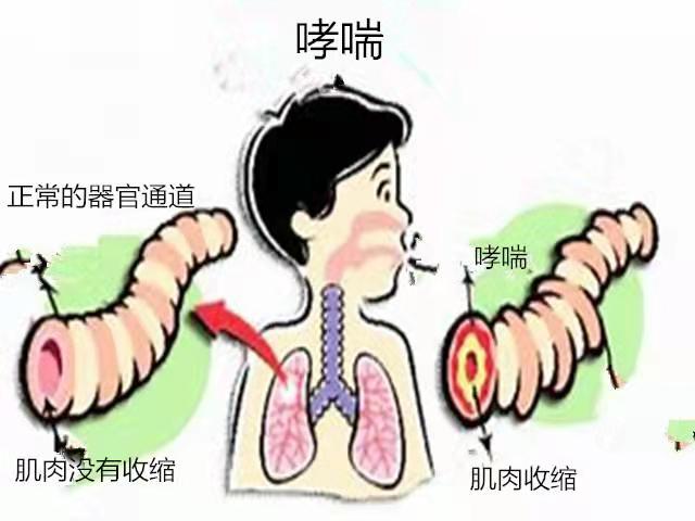 6155a7bfd3860.jpg 6155a7bfd3860.jpg