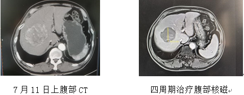 668cf6b9f4075.png